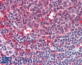 Anti-SYK Antibody (aa5-360) IHC-plus LS-B2240