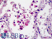 Anti-TLR8 Antibody (aa750-850, FITC) IHC-plus LS-B2241