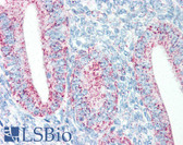 Anti-HSPD1 / HSP60 Antibody IHC-plus LS-B2243