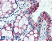 Anti-CLDN4 / Claudin 4 Antibody (C-Terminus) IHC-plus LS-B2257