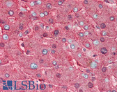 Anti-HP / Haptoglobin Antibody IHC-plus LS-B2266