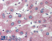 Anti-PTHR / PTHR1 Antibody IHC-plus LS-B2267