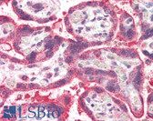 Anti-NEIL1 Antibody (C-Terminus) IHC-plus LS-B2278