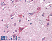 Anti-TOMM70A Antibody (aa1-100) IHC-plus LS-B2303