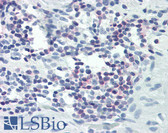 Anti-PLCG1 Antibody (C-Terminus) IHC-plus LS-B2311