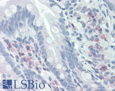 Anti-CKS1B / CKS1 Antibody (C-Terminus) IHC-plus LS-B2315