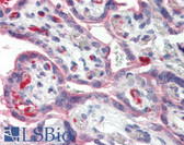 Anti-SELE / CD62E / E-selectin Antibody IHC-plus LS-B2323