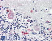 Anti-NOG / Noggin Antibody (Internal) IHC-plus LS-B2338