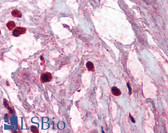 Anti-TPSAB1 / Mast Cell Tryptase Antibody (clone AA1) IHC-plus LS-B2347