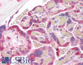 Anti-STXBP2 Antibody (aa58-70) IHC-plus LS-B2356