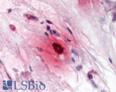 Anti-TPSAB1 / Mast Cell Tryptase Antibody IHC-plus LS-B2357