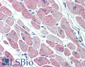 Anti-CLIC4 Antibody (N-Terminus) IHC-plus LS-B2383