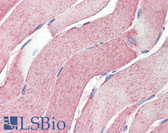 Anti-ABCA1 Antibody (aa1800-2260, clone A00121.01) IHC-plus LS-B2384