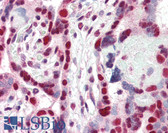 Anti-CBX3 / HP1 Gamma Antibody (Internal) IHC-plus LS-B2396