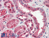 Anti-Aspartate Aminotransferase Antibody (aa157-167) IHC-plus LS-B2405