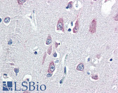 Anti-VPS25 Antibody (N-Terminus) IHC-plus LS-B2409