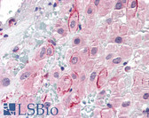 Anti-SPP1 / Osteopontin Antibody (C-Terminus) IHC-plus LS-B2411