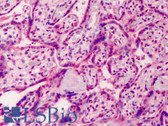 Anti-GDF15 Antibody (C-Terminus) IHC-plus LS-B2413