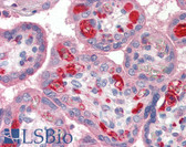 Anti-PLTP Antibody IHC-plus LS-B2416