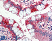 Anti-APOA4 Antibody (Internal) IHC-plus LS-B2417