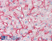 Anti-SLC2A2 / GLUT2 Antibody IHC-plus LS-B2421