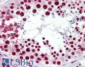 Anti-HNRPM / HNRNPM Antibody (aa161-182) IHC-plus LS-B2427