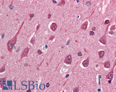 Anti-MAP1B Antibody IHC-plus LS-B2428