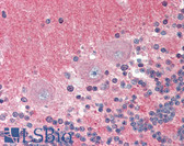 Anti-SNAP25 Antibody (aa195-206) IHC-plus LS-B2432