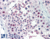 Anti-PRMT5 Antibody (aa100) IHC-plus LS-B2433