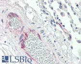 Anti-PGIS / PTGIS Antibody (aa475-490) IHC-plus LS-B2436
