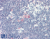 Anti-SDF1 / CXCL12 Antibody IHC-plus LS-B2437