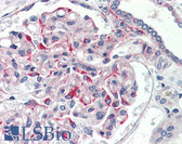 Anti-JAG1 / Jagged 1 Antibody (aa110-125) IHC-plus LS-B2442