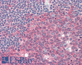 Anti-PKM / Pyruvate Kinase Antibody IHC-plus LS-B2445