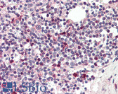 Anti-TFEC Antibody (Internal) IHC-plus LS-B2458