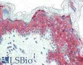 Anti-KRT1 / CK1 / Cytokeratin 1 Antibody (clone LHK1) IHC-plus LS-B2460