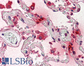 Anti-TPSAB1 / Mast Cell Tryptase Antibody IHC-plus LS-B2478