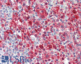 Anti-GSN / Gelsolin Antibody IHC-plus LS-B2480