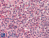 Anti-CXCR4 Antibody (aa14-40) IHC-plus LS-B2484