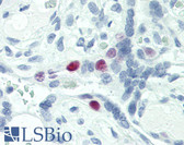Anti-SKP2 Antibody IHC-plus LS-B2487
