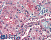 Anti-SOCS1 Antibody (C-Terminus) IHC-plus LS-B2488