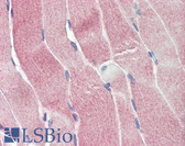Anti-SIRT4 / Sirtuin 4 Antibody (C-Terminus) IHC-plus LS-B2493