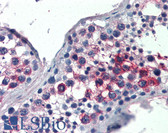Anti-SLIM / FHL1 Antibody (Internal) IHC-plus LS-B2495