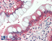 Anti-NRAS / N-ras Antibody (Internal) IHC-plus LS-B2501