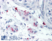 Anti-CDC25A Antibody (phospho-Ser17) IHC-plus LS-B2504