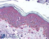 Anti-SERPINF1 / PEDF Antibody (N-Terminus) IHC-plus LS-B2505