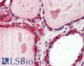 Anti-CTSK / Cathepsin K Antibody IHC-plus LS-B2512