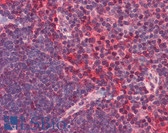 Anti-CXCR6 Antibody (N-Terminus) IHC-plus LS-B2518