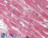 Anti-S100A4 / FSP1 Antibody IHC-plus LS-B2520