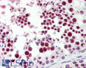 Anti-EZH2 Antibody (Internal) IHC-plus LS-B2528