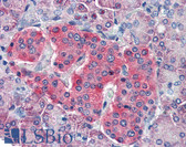 Anti-LRRK2 Antibody (aa1838-2133) IHC-plus LS-B2530